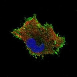 beta-Catenin Antibody (CL3689), Novus Biologicals:Antibodies:Primary Antibodies